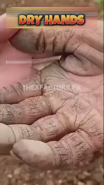 Winter Bundle Silicone Socks+Gloves